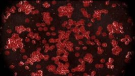 Transfusion Physician