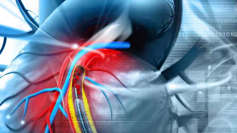 Transplant Vascular Surgeon