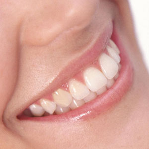 Consultant Dental Surgeon And Prosthodontist