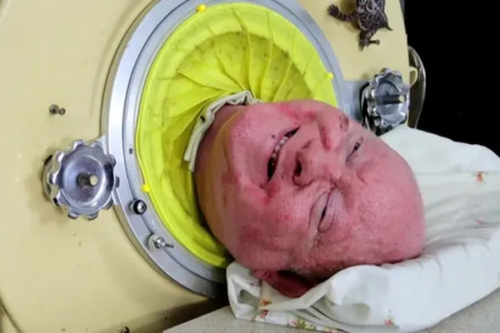 Paul Alexander: 'Man in the iron lung' dies at the age of 78